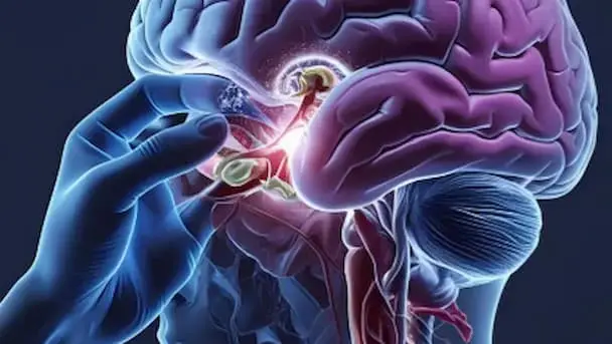 stereotactic_biopsy