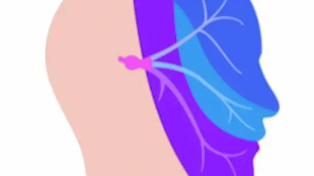 trigeminal_neuralgia
