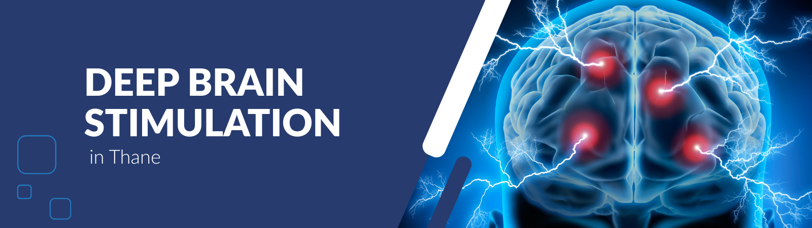 Deep Brain Stimulation in Thane