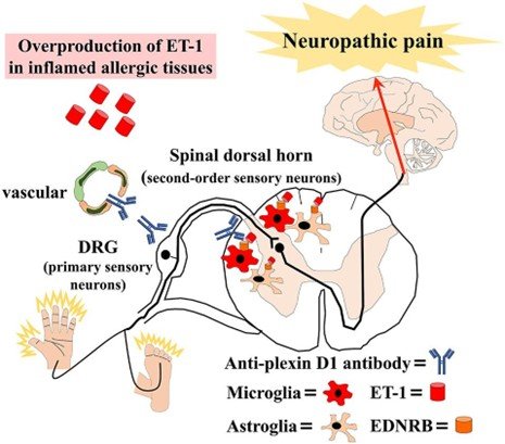 Radiofrequency lesioning