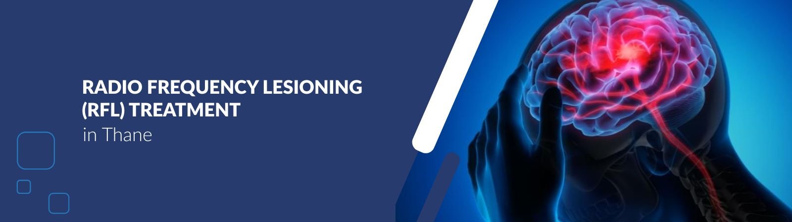 Radio frequency Lesioning (RFL) Treatment in thane Banner