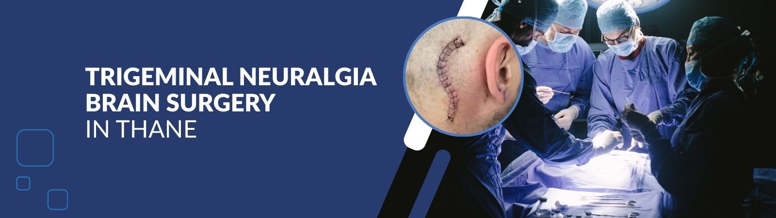 Trigeminal_Neuralgia_Brain_Surgery__in_Thane