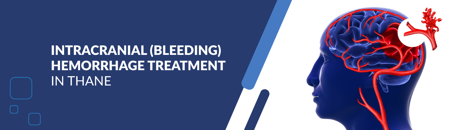 Diagnostic_Angiography_for_Vascular_Conditions_of_the_Brain