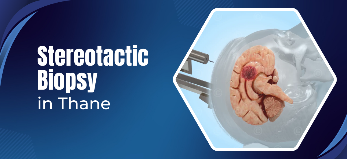 steriotactic biopsy in thane