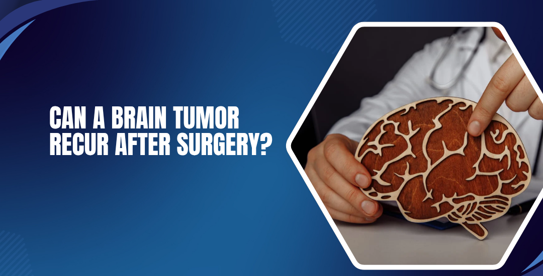 Can a Brain Tumor Recur After Surgery?