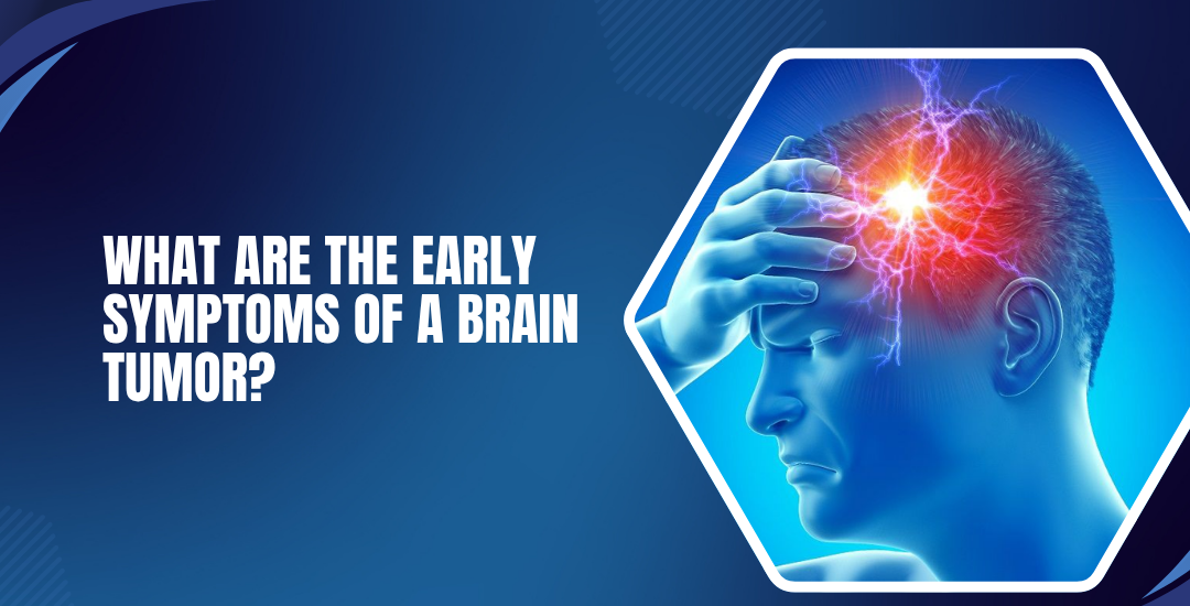 What Are the Early Symptoms of a Brain Tumor?