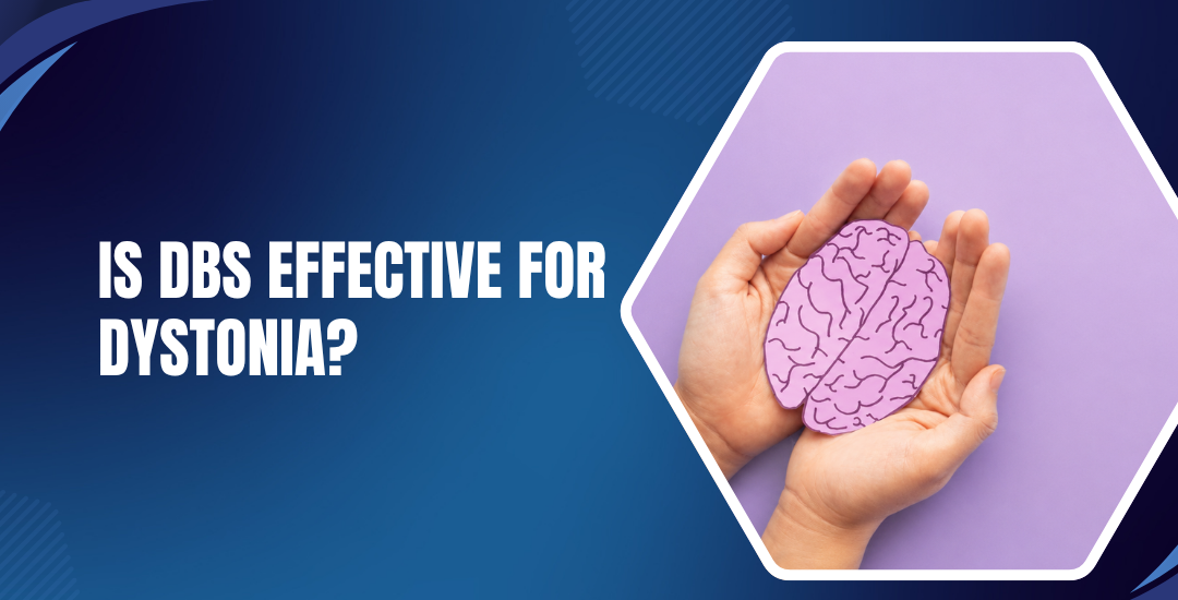 Is DBS Effective for Dystonia