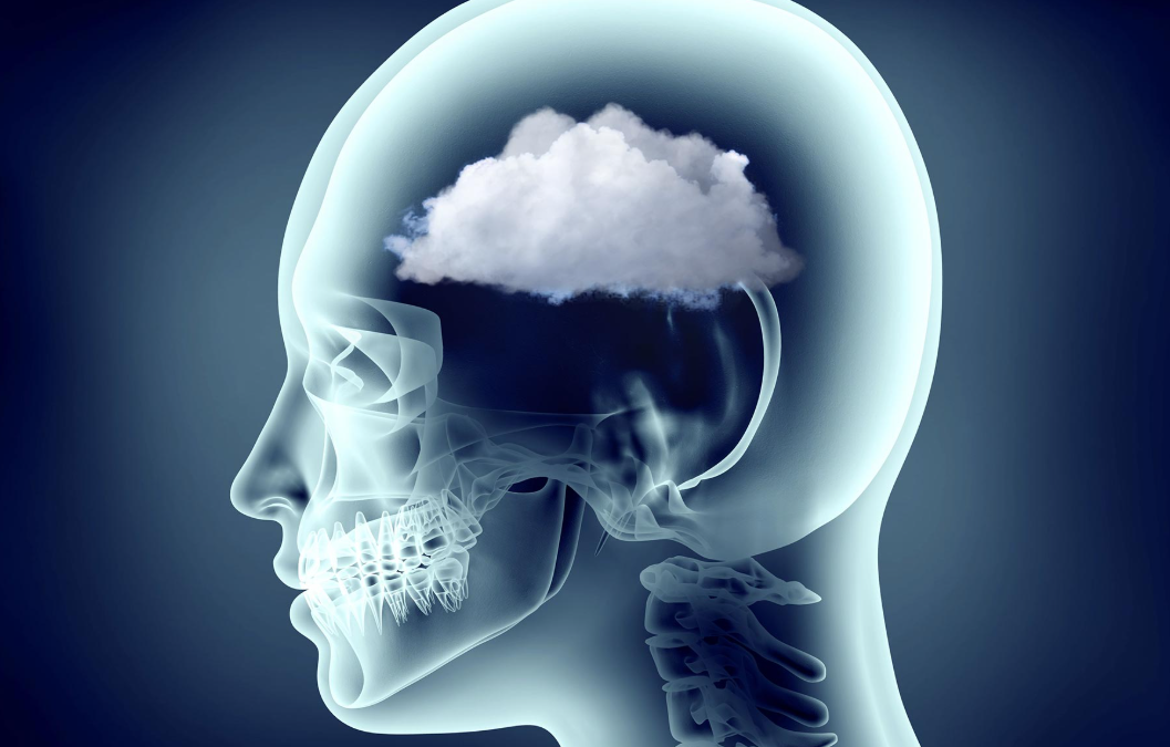 Why Does My Head Feel Foggy? When to See a Neurosurgeon?