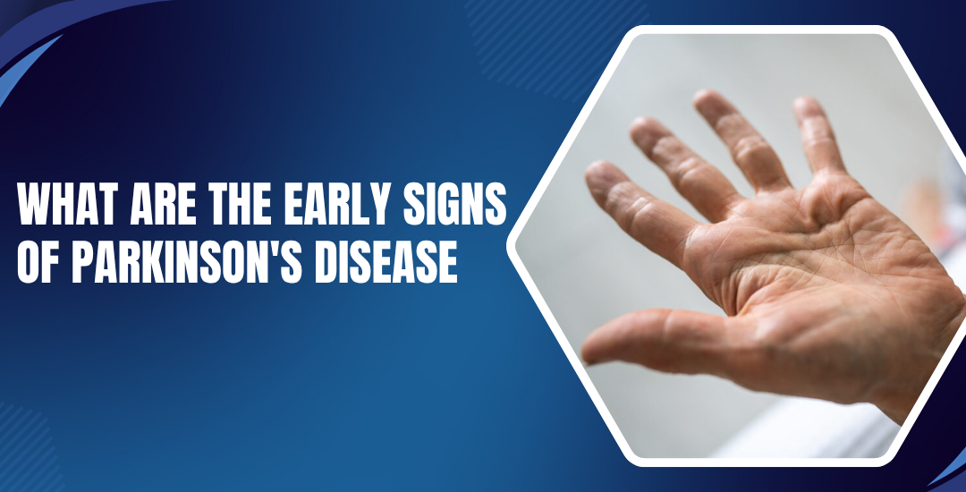 What Are the Early Signs of Parkinson’s Disease?