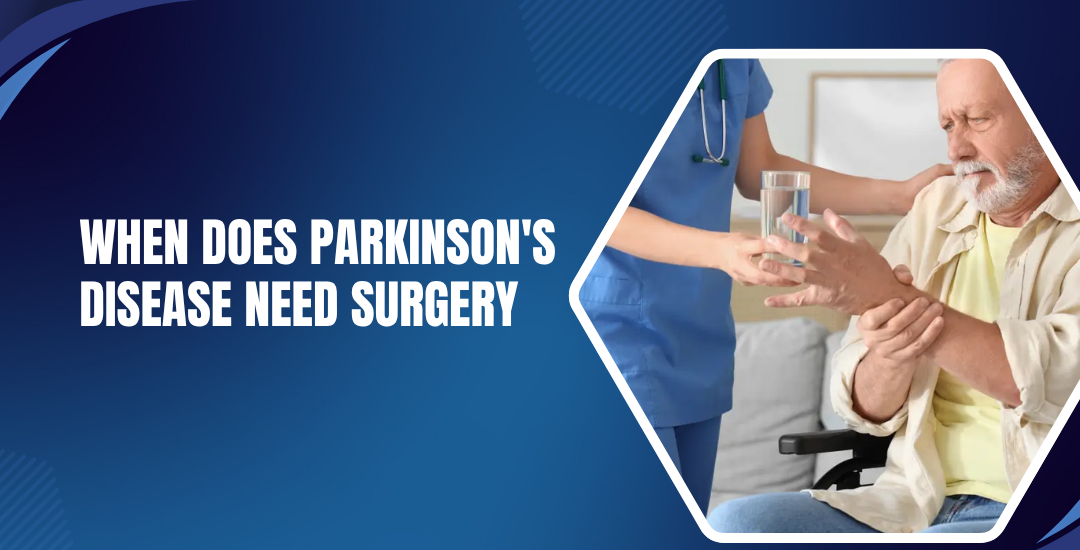 When Does Parkinson's Disease Need Surgery